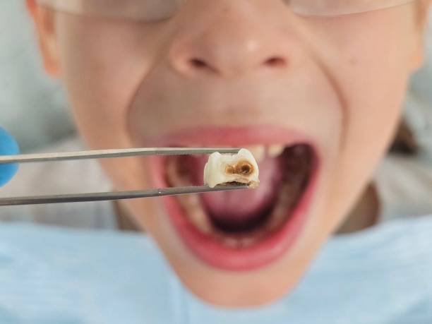 Best Orthodontic Emergency Dentist in Roeland Park, KS